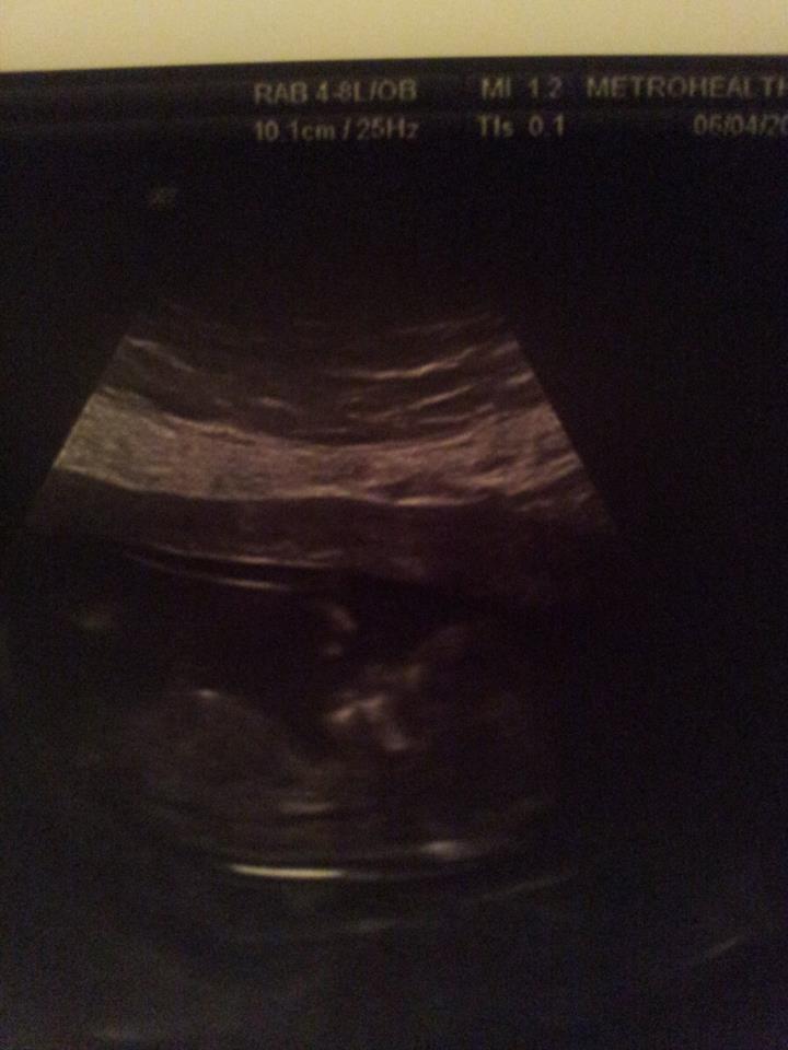 Belly_Nugget_12_Weeks_5_Days.jpg