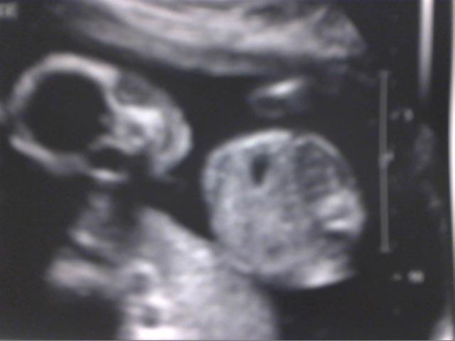 Picture_10.jpg