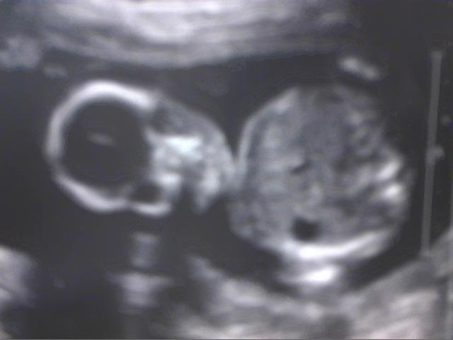 Picture_11.jpg
